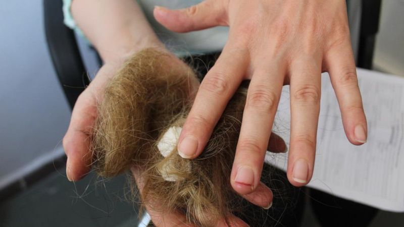 Gaziantep'te kadın hasta hemşireye saldırdı