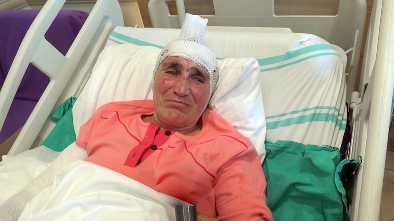 Erzincan'da tandıra düşen kadın, yaşadıklarını anlattı