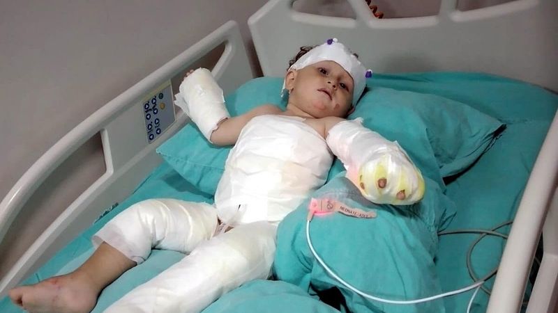 İzmir'de yaşayan genç kadın ve oğlu, cezaevinden çıkan eşi tarafından yakıldı