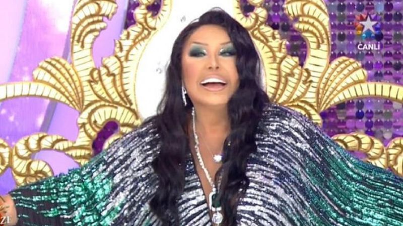 Bülent Ersoy'un yüzündeki değişiklik çok konuşulmuştu! Sırrı ortaya çıktı