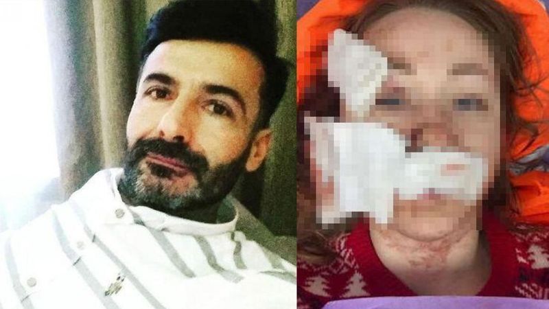 Bakırköy'de eşini falçata ile yaralayan sanığa 11 yıl 8 ay hapis cezası