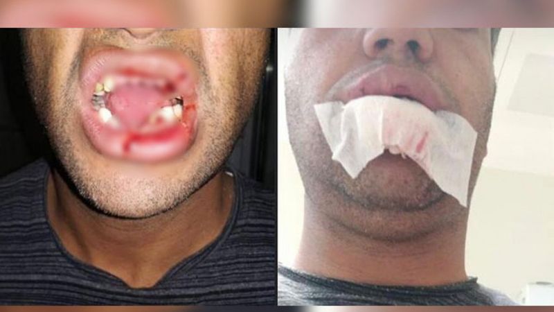 Şanlıurfa'da aşı uygulanan inek veterineri hastanelik etti