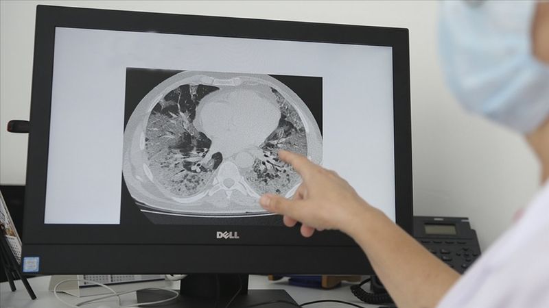 Sağlık Bakanı Koca'dan zatürre uyarısı