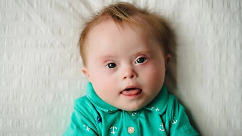 Yargıtay’dan down sendromlu çocukların ailelerini yakından ilgilendiren karar