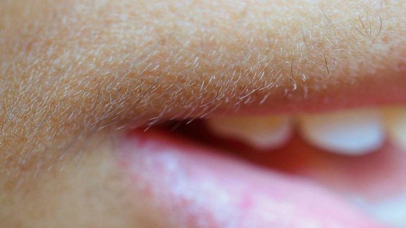 Yüzdeki tüyleri yok eden 10 basit yöntem