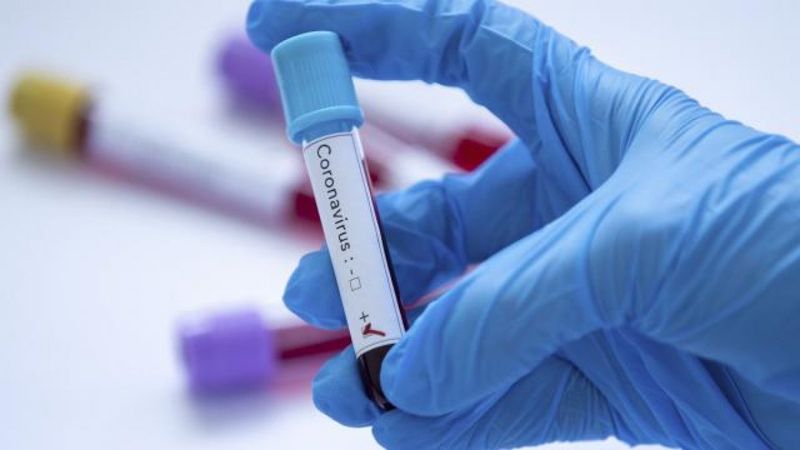 Bugünkü vaka tablosu açıklandı mı? 23 Kasım 2021 vaka ve ölüm sayısı