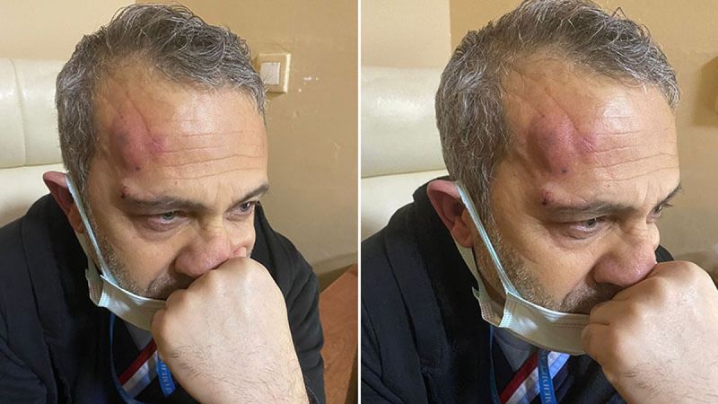 Şanlıurfa'da hemşireyi darbeden 2 hasta yakını tutuklandı