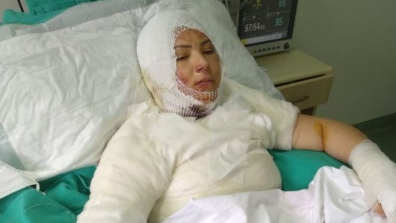 Ordu'da eski eşini yakan kişi: Kazayla oldu