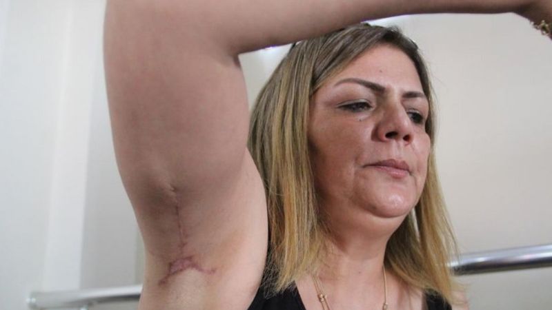 Antalya'da bir kadın estetik mağduru oldu