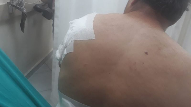 Bartın’da ayı saldırısı: Yerden yere vurdu