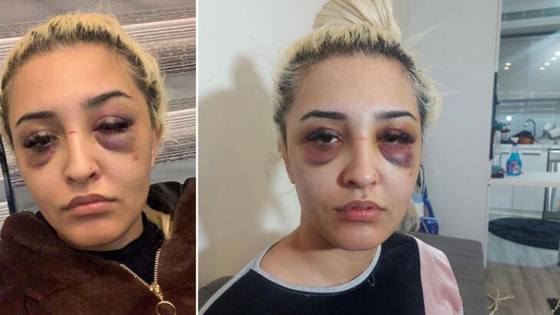 İzmir’de genç kadın, dayakçı sevgilisi ile barıştı