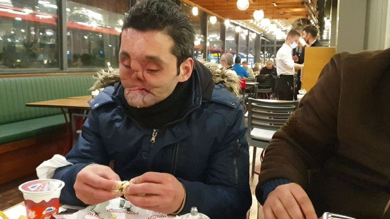 Kendini vuran Ahmet’in tek hayali normal insanlar gibi yaşamak