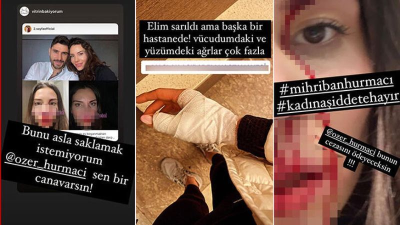 Mihriban ve Özer Hurmacı arasındaki darp davasında karar