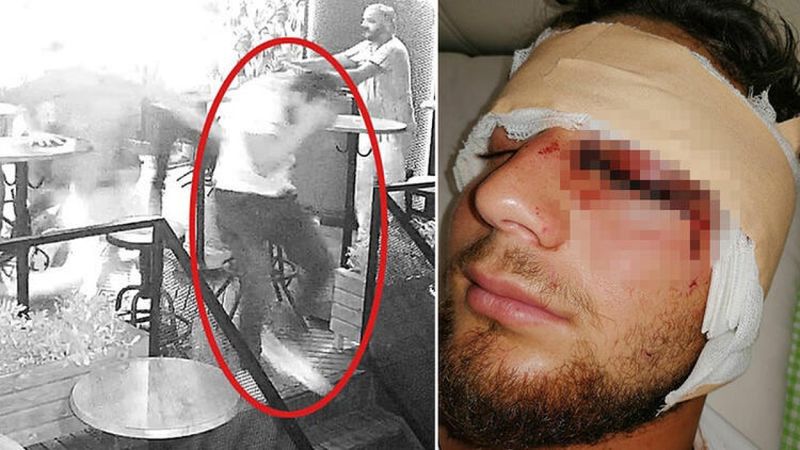 İzmir’de kavgayı ayırmak isterken gözünü kaybetti, adalet bekliyor