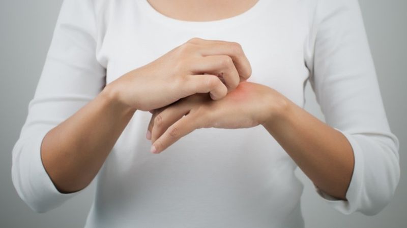 Uyuz tedavisinde sirke kullanmak işe yarar mı?