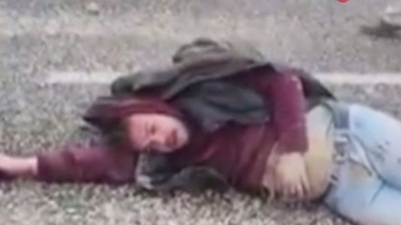 Gaziantep'te kaza yaptı, ‘yüzümde şişlik var mı’ diye sordu