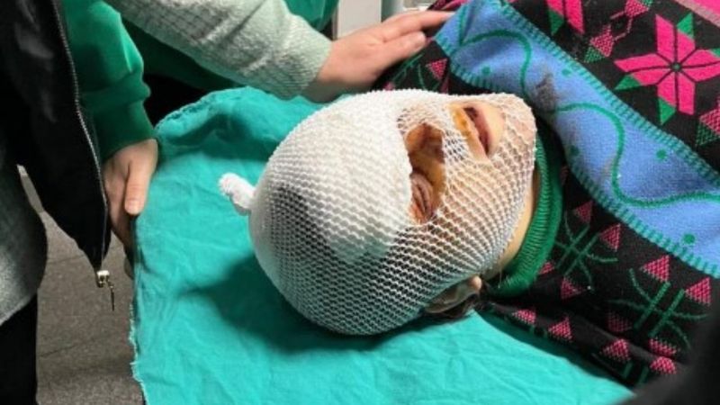 Sakarya'da bir kadın eski dini nikahlı eşi tarafından bıçaklandı