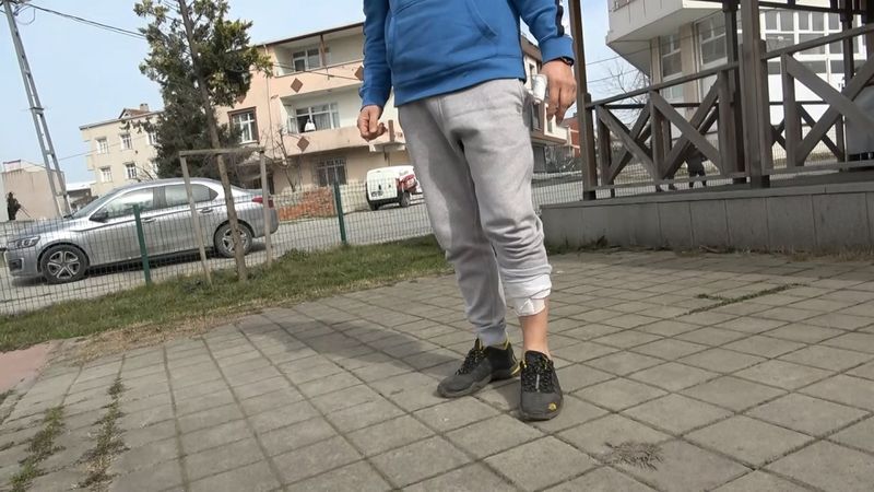 Arnavutköy'de ailesiyle sokakta yürüyen 3 çocuğa köpek saldırdı: 1 çocuk yaralandı