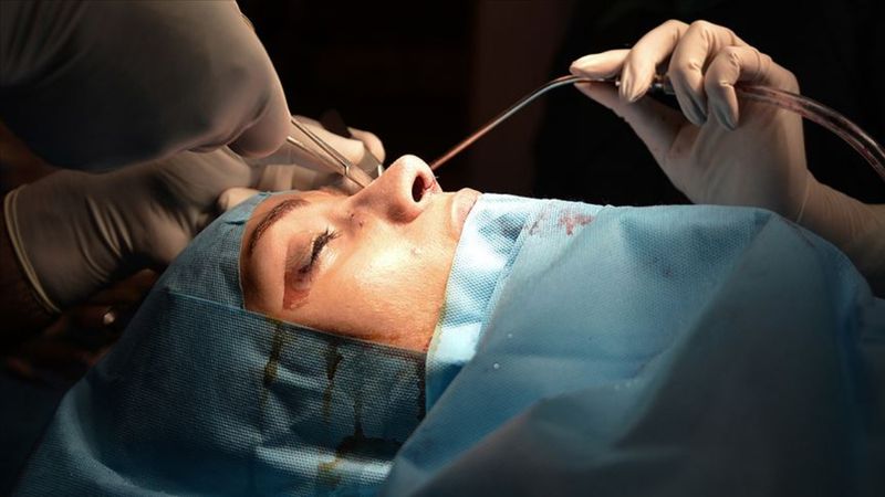 Estetik caiz mi? İşte Diyanetin ayetlerle açıkladığı fetva