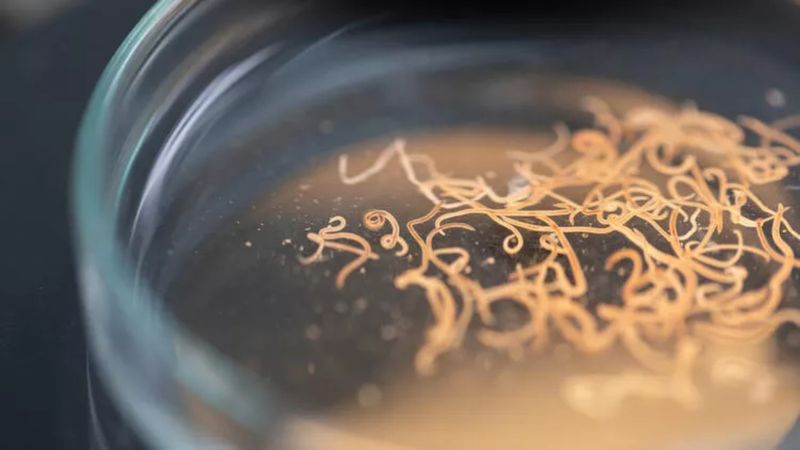 Gözünüz üzerinde olsun! O parazit dışkıda saklanıyor...