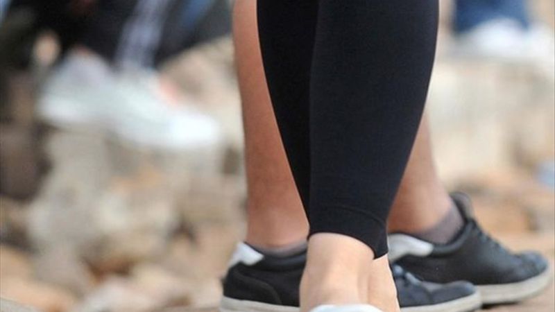 Varis hastalığı ile ilgili tüm detaylar! Sıcak havalar varis hastalığını tetikliyor