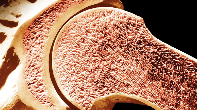 Kemiklerini seven her gün içsin! Boşlukları kolajenle dolduruyor...