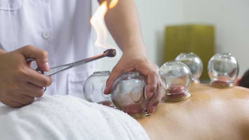 Devlet hastaneleri hacamat yapıyor mu? Hacamat yapan devlet hastaneleri 2023