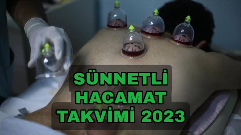 Sünnetli Hacamat Günleri 2023: Kasım ayında hangi günler yapılmalı