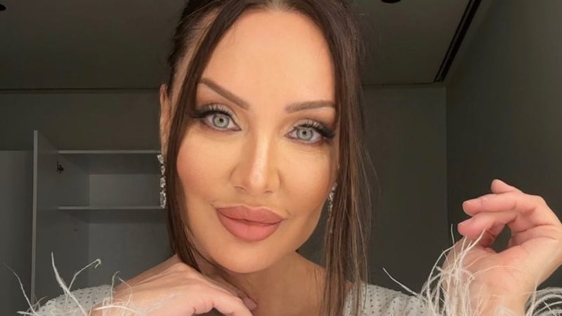 Umut Akyürek'in son yaptırdığı estetik operasyon şoke etti: Alın daraltma