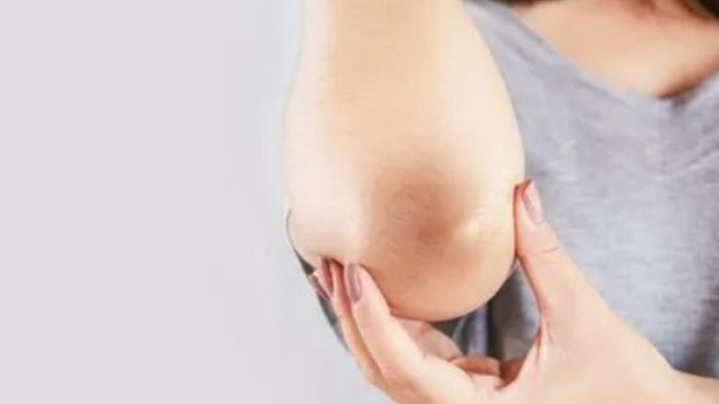 Diz ve dirseklerdeki kararmalar tarih oluyor! Tek yapmanız gereken evdeki bu iki malzemeyi karıştırmak…