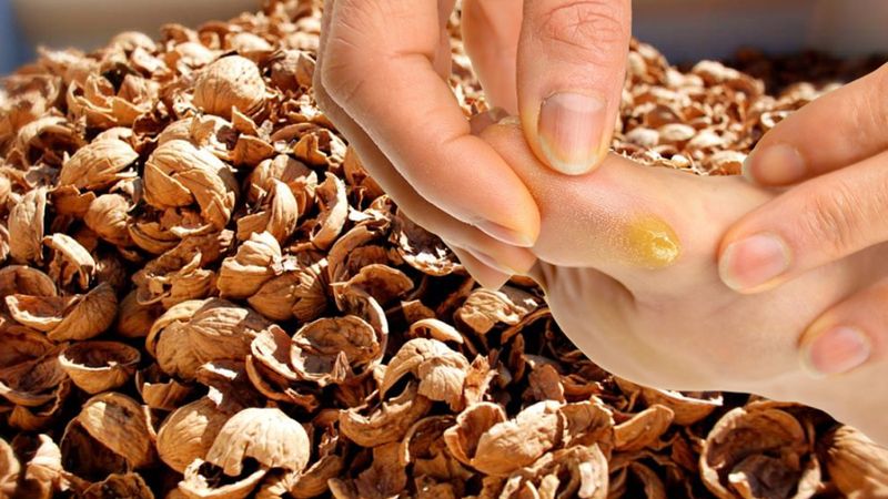 Nasırın doğal çözümü ceviz kabuklarındaymış! İşte, kabuklardan gelen o mucize yöntem…