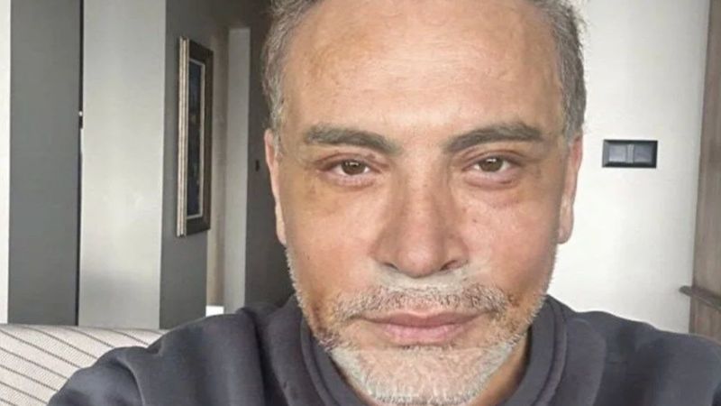 Cenk Eren gerdirdikten sonraki halini paylaştı! O detay dikkat çekti