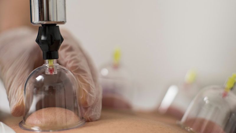 Hacamat takvimi 2024: Mayıs ayında sünnet olan günler