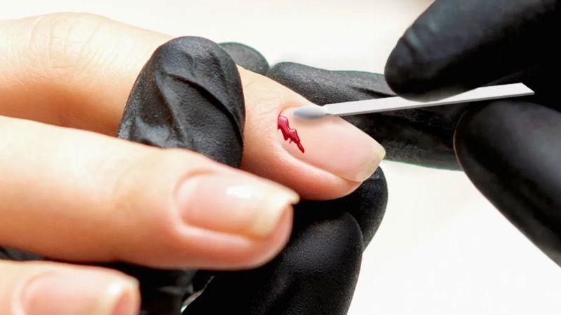 Kan taşı (cilt şapı) nedir, ne işe yarar? Kan taşı nasıl kullanılır?