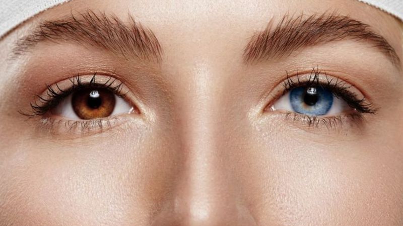Bu kadarı da pes dedirtti! Göz rengini kahverengiden maviye bakın nasıl çevirtti…