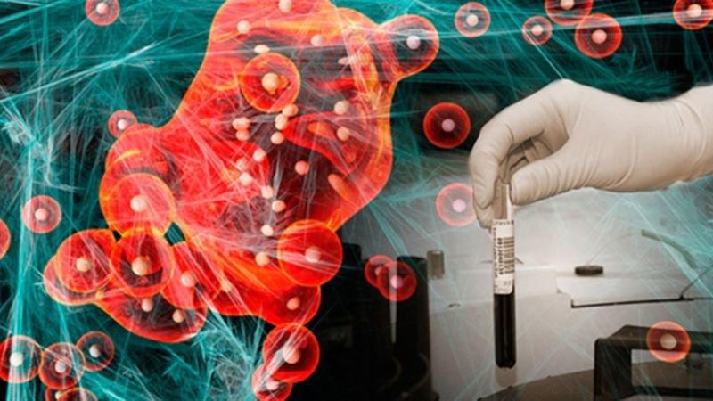 İskoçya'da kanserin tespiti için yapay zeka temelli bilgisayar programı geliştirildi