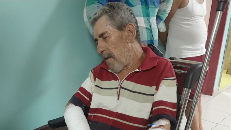 Balıkesir'de köpek saldırısında yaralanan kişinin bileği kırıldı