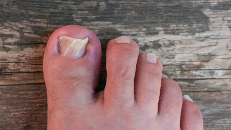 Tırnak batığınıza o yöntemi uygulayın, batıklar tek hamlede nasıl çıkıyor görün…