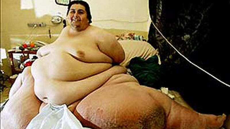 Dünyanın en kilolu insanının ağırlığı şoke edici: Ne 200, ne 300...