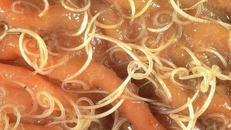 Dikkat! İnsan Cildinde Üreyen 5 Tehlikeli Parazit