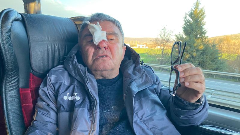 Deplasman dönüşü saldırı! Sportif direktörün burnu kırıldı