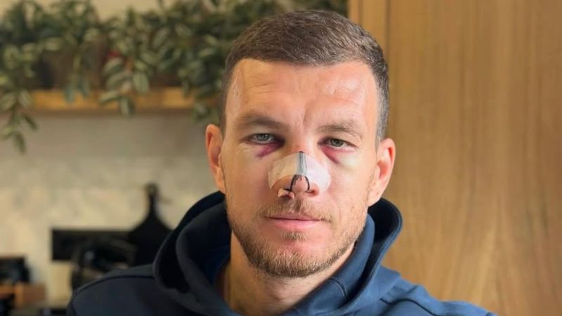 Edin Dzeko, son halini paylaştı