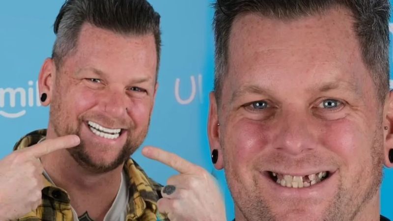 İngiltere'de enerji içeceğinden çürüyen dişlerini Türkiye'de yaptırdı