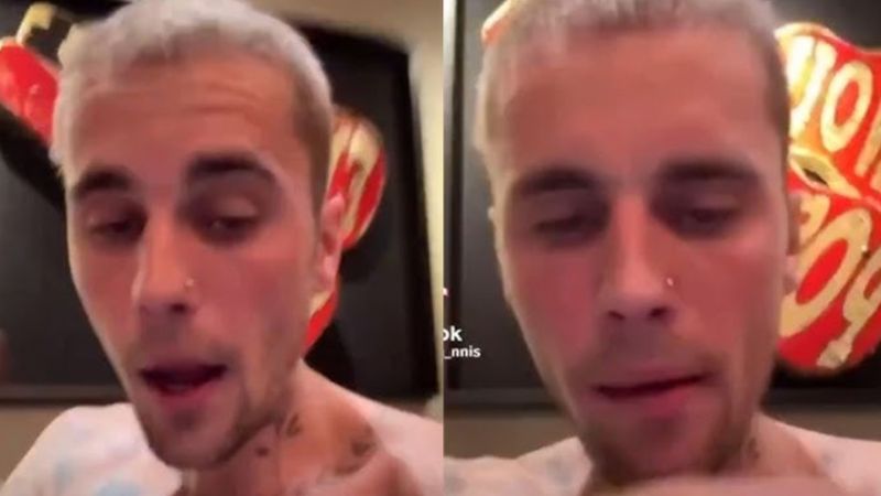 Justin Bieber'ın son hali hayranlarını endişelendirdi! Yorgun ve moralsiz