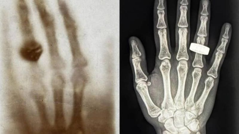 Astronotlar uzayda llk röntgeni çekti: Peki bu neden önemli