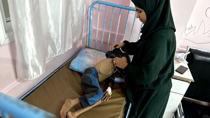 Gazze'de çocukların yetersiz beslenme vakaları giderek artıyor