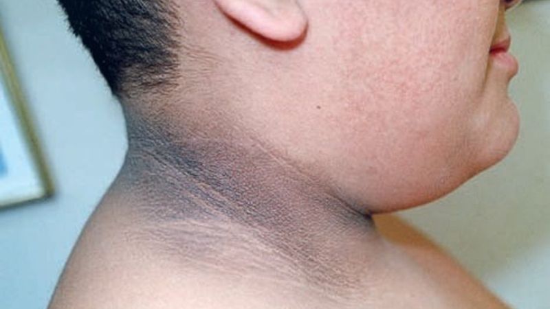 Enseyi kararttıysanız dikkat: Bakın neyin habercisi..