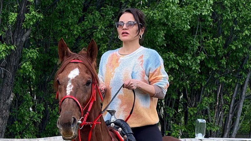 Estetik iddiaları vardı! Göksel sosyal medyadan açıklama yaptı