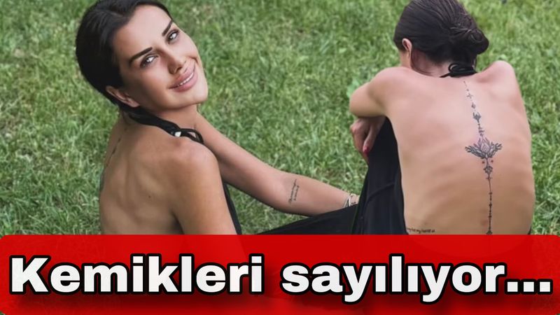 Dilan Polat'ın zayıflığı şaşırttı