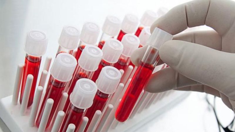 Gülen yüzlerin sırrı kanlarında saklı! İşte en neşeli kan grubu